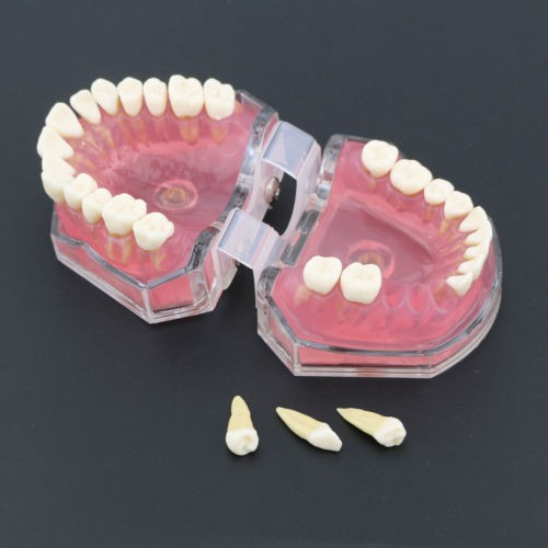 Макет челюсти человека с зеркалом для рта и инструментами для реставрации зубов